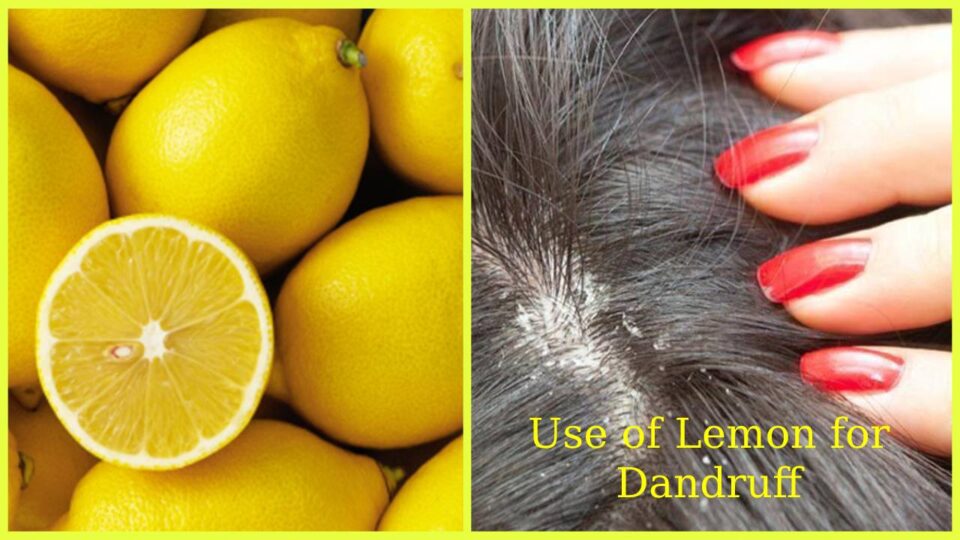 Lemon Juice for Hair Benefits of lemon for hair & scalp, Lemon Hair Mask
