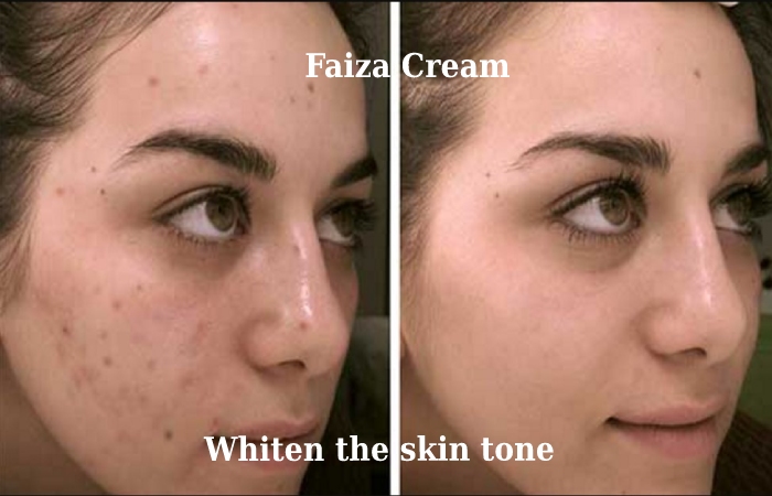 Features of faiza Cream