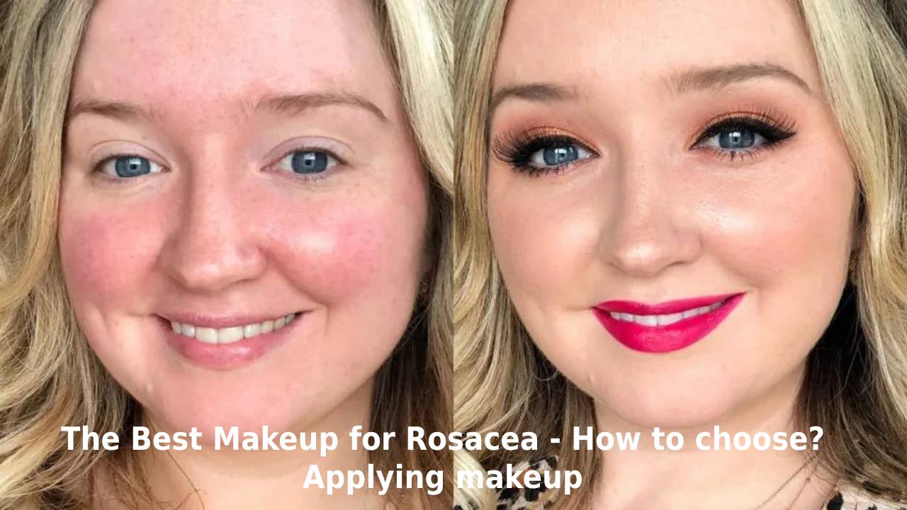  The Best Makeup for Rosacea – How to choose? Applying makeup for Rosacea