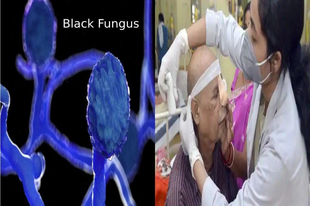 Black Fungus