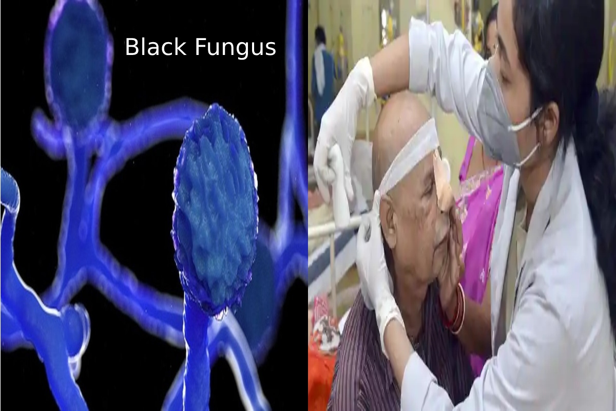  Black fungus – Symptoms, Precautions, Treatment, How many cases are present in India?