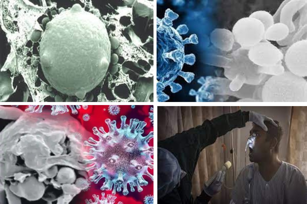 White Fungus– Causes, Why are Covid-19 patients prone to white fungi?