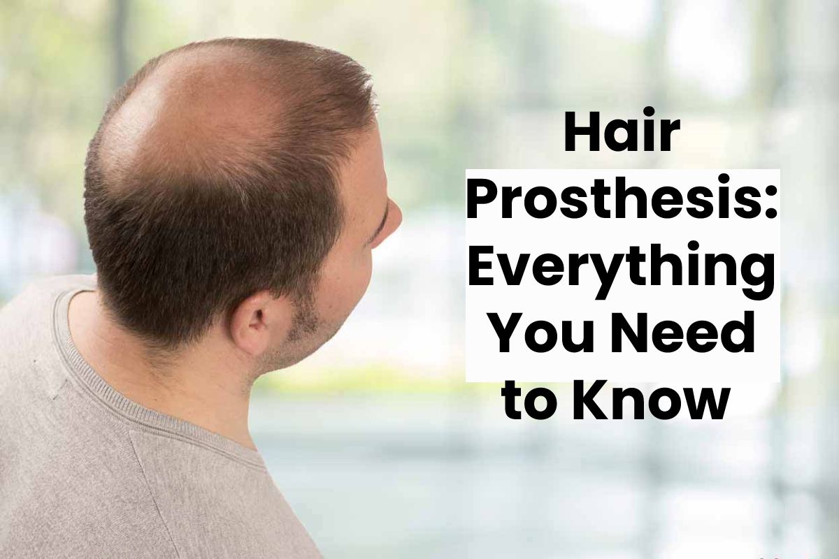  Hair Prosthesis: Everything You Need to Know 