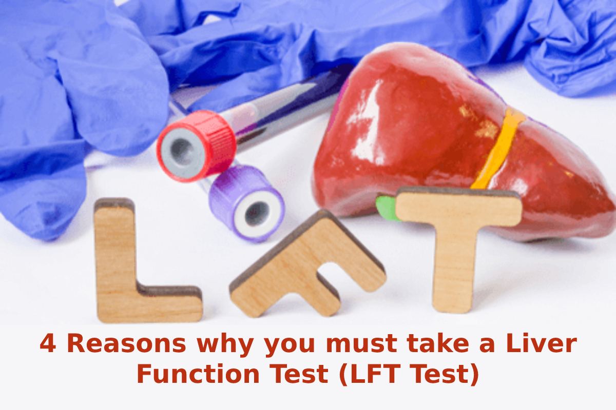 4 Reasons why you must take a Liver Function Test (LFT Test)