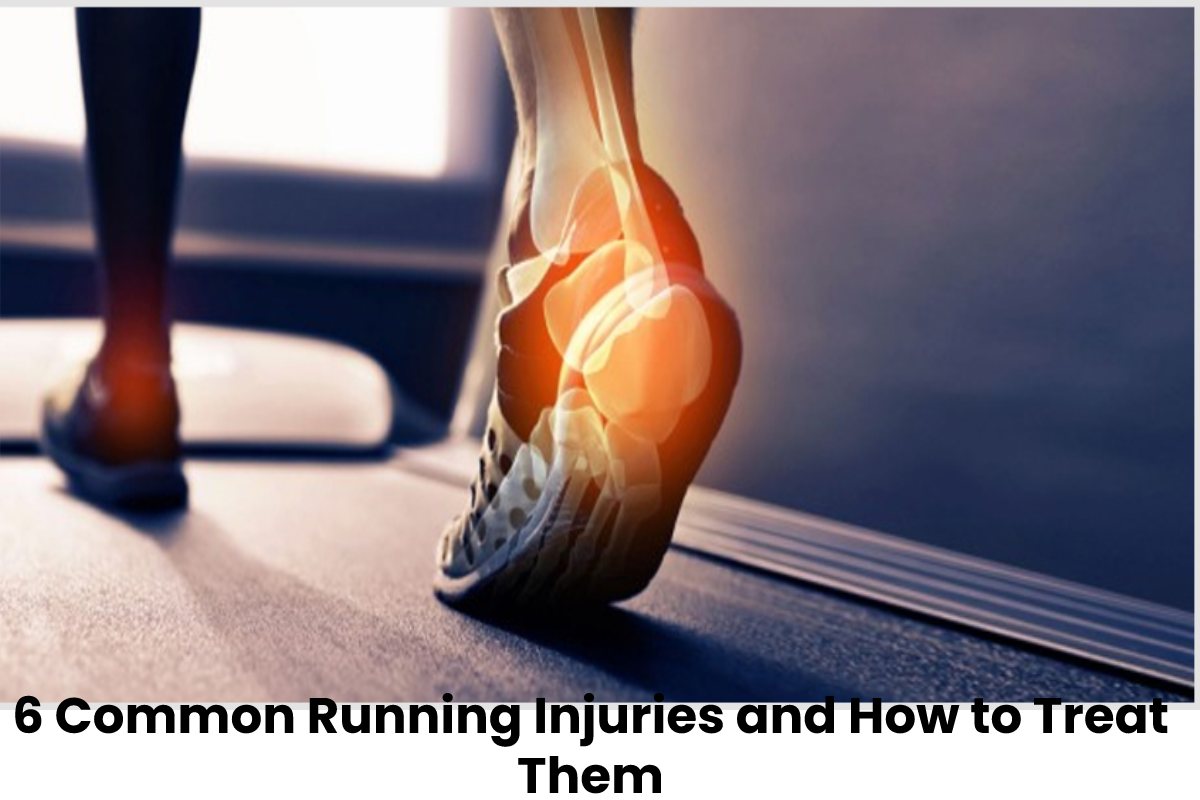 6 Common Running Injuries and How to Treat Them