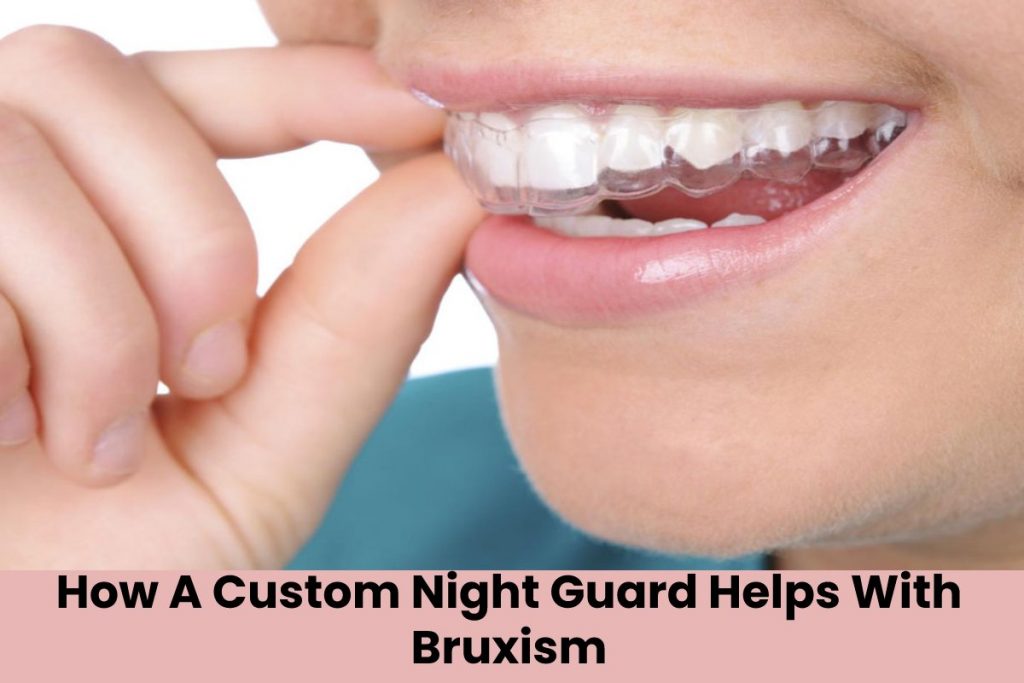 How A Custom Night Guard Helps With Bruxism