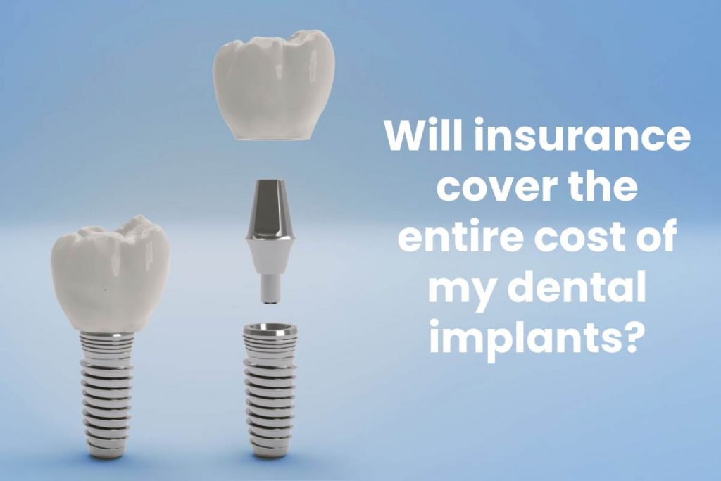 Will insurance cover the entire cost of my dental implants?