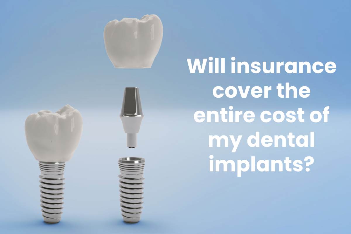 Will insurance cover the entire cost of my dental implants?